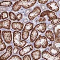 Immunohistochemistry (Formalin/PFA-fixed paraffin-embedded sections) - Anti-DNAJC16 antibody (AB122855), expandable thumbnail