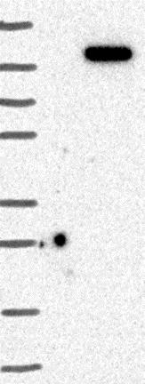 Western blot - Anti-DNAJC16 antibody (AB122855), expandable thumbnail