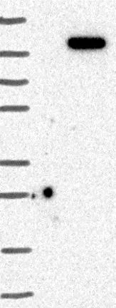 Western blot - Anti-DNAJC16 antibody (AB122855)