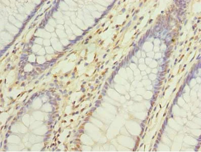 Immunohistochemistry (Formalin/PFA-fixed paraffin-embedded sections) - Anti-DNAJC17 antibody (AB235350)