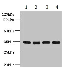 Western blot - Anti-DNAJC17 antibody (AB235350)