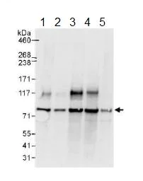 Western blot - Anti-DNAJC2/ZRF1 antibody (AB134572)