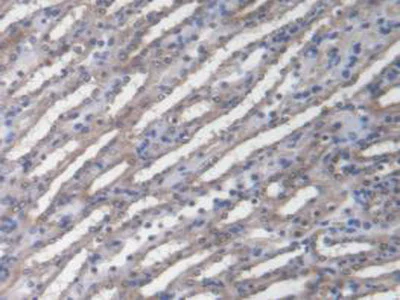 Immunohistochemistry (Formalin/PFA-fixed paraffin-embedded sections) - Anti-DNAJC2/ZRF1 antibody (AB231318)