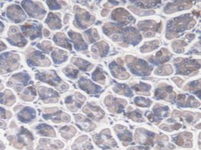 Immunohistochemistry (Formalin/PFA-fixed paraffin-embedded sections) - Anti-DNAJC2/ZRF1 antibody (AB231318), expandable thumbnail
