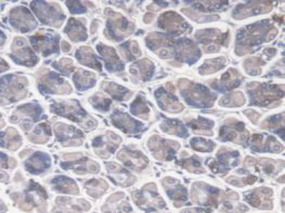 Immunohistochemistry (Formalin/PFA-fixed paraffin-embedded sections) - Anti-DNAJC2/ZRF1 antibody (AB231318)