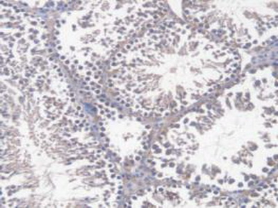 Immunohistochemistry (Formalin/PFA-fixed paraffin-embedded sections) - Anti-DNAJC2/ZRF1 antibody (AB231318), expandable thumbnail