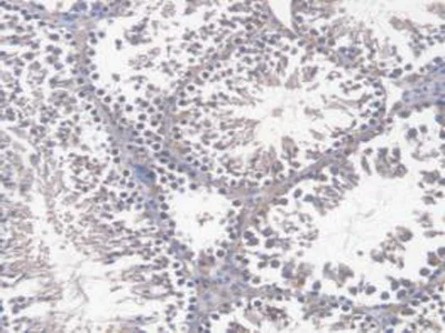 Immunohistochemistry (Formalin/PFA-fixed paraffin-embedded sections) - Anti-DNAJC2/ZRF1 antibody (AB231318)