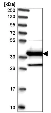 Western blot - Anti-DNAJC22 antibody (AB220239)