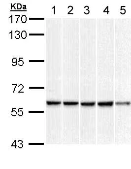 Western blot - Anti-DNAJC3 antibody (AB154714)