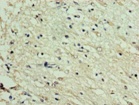 Immunohistochemistry (Formalin/PFA-fixed paraffin-embedded sections) - Anti-DNAJC30 antibody (AB235417)