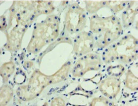 Immunohistochemistry (Formalin/PFA-fixed paraffin-embedded sections) - Anti-DNAJC30 antibody (AB235417)