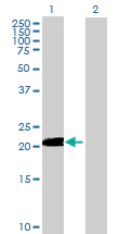 Western blot - Anti-DNAJC5B antibody (AB69262)