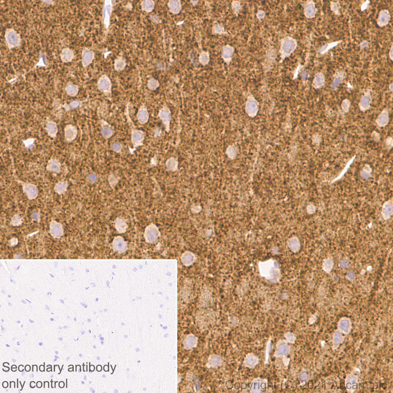 Immunohistochemistry (Formalin/PFA-fixed paraffin-embedded sections) - Anti-DNAJC5B antibody [EPR24152-62] (AB259867)