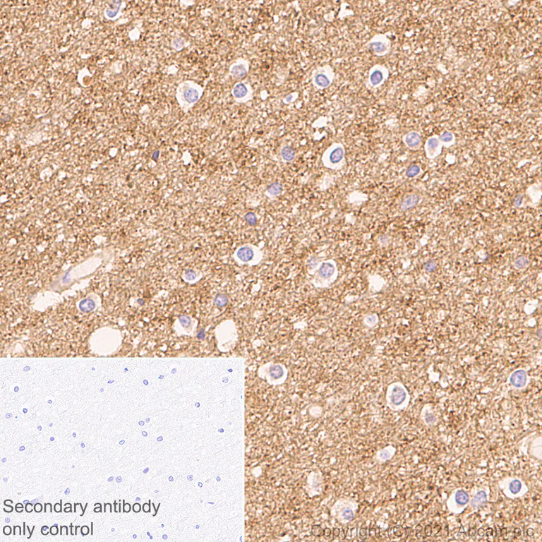 Immunohistochemistry (Formalin/PFA-fixed paraffin-embedded sections) - Anti-DNAJC5B antibody [EPR24152-62] (AB259867)