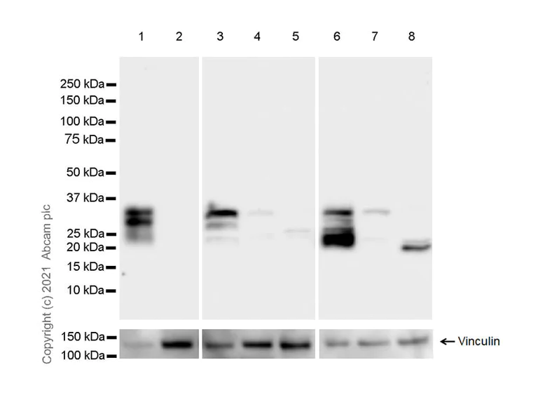 Western blot - Anti-DNAJC5B antibody [EPR24152-62] (AB259867)