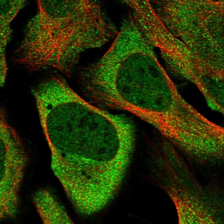 Immunocytochemistry/ Immunofluorescence - Anti-DNAJC6 antibody (AB262876)