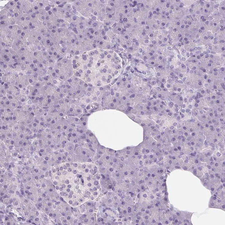 Immunohistochemistry (Formalin/PFA-fixed paraffin-embedded sections) - Anti-DNAJC6 antibody (AB262876)