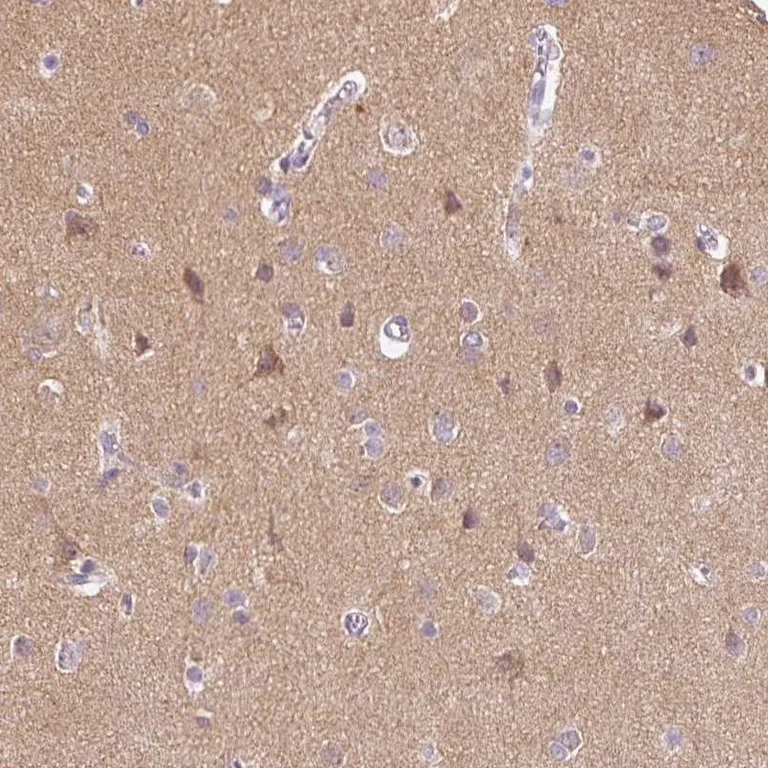 Immunohistochemistry (Formalin/PFA-fixed paraffin-embedded sections) - Anti-DNAJC6 antibody (AB262876)