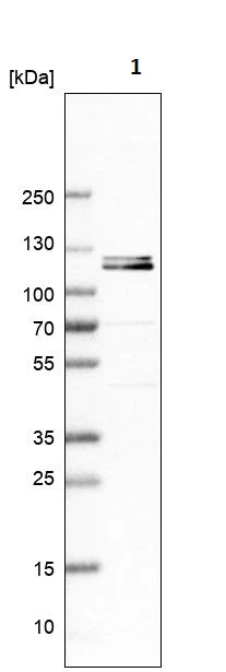 Western blot - Anti-DNAJC6 antibody (AB262876)
