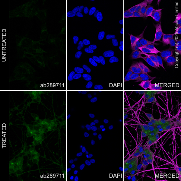 Immunocytochemistry/ Immunofluorescence - Anti-DNAJC6 antibody [EPR25332-124] (AB289711)
