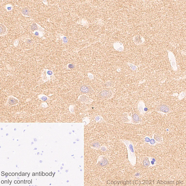 Immunohistochemistry (Formalin/PFA-fixed paraffin-embedded sections) - Anti-DNAJC6 antibody [EPR25332-124] (AB289711)
