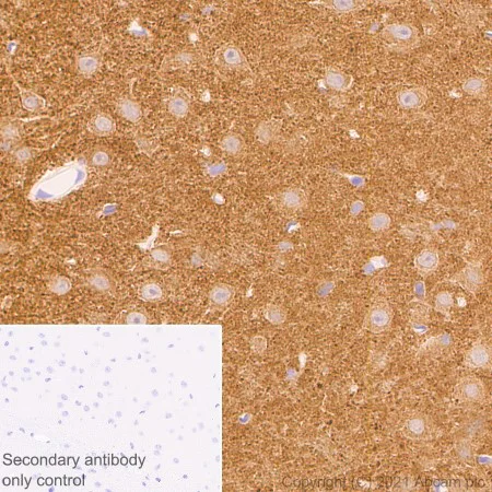 Immunohistochemistry (Formalin/PFA-fixed paraffin-embedded sections) - Anti-DNAJC6 antibody [EPR25332-124] - BSA and Azide free (AB289712)