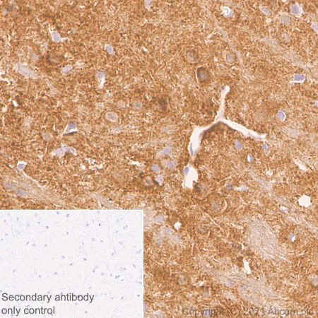 Immunohistochemistry (Formalin/PFA-fixed paraffin-embedded sections) - Anti-DNAJC6 antibody [EPR25332-124] - BSA and Azide free (AB289712)