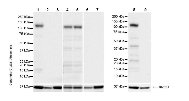 Western blot - Anti-DNAJC6 antibody [EPR25332-124] - BSA and Azide free (AB289712)