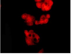 Immunocytochemistry/ Immunofluorescence - Anti-DNAJC7 antibody [EPR13349] - N-terminal (AB179830), expandable thumbnail