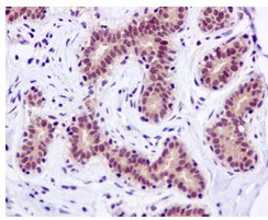 Immunohistochemistry (Formalin/PFA-fixed paraffin-embedded sections) - Anti-DNAJC7 antibody [EPR13349] - N-terminal (AB179830)