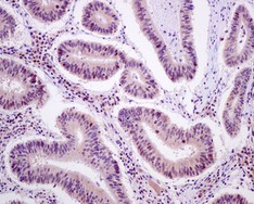 Immunohistochemistry (Formalin/PFA-fixed paraffin-embedded sections) - Anti-DNAJC7 antibody [EPR13349] - N-terminal (AB179830), expandable thumbnail