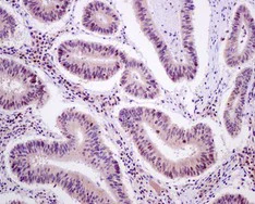 Immunohistochemistry (Formalin/PFA-fixed paraffin-embedded sections) - Anti-DNAJC7 antibody [EPR13349] - N-terminal (AB179830)