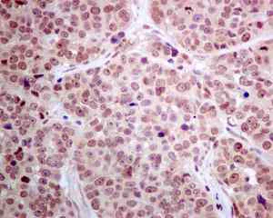 Immunohistochemistry (Formalin/PFA-fixed paraffin-embedded sections) - Anti-DNAJC9 antibody [EPR9856] (AB166612)