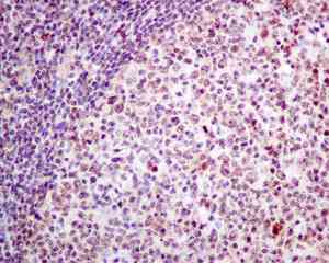 Immunohistochemistry (Formalin/PFA-fixed paraffin-embedded sections) - Anti-DNAJC9 antibody [EPR9856] (AB166612)