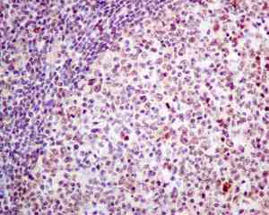 Immunohistochemistry (Formalin/PFA-fixed paraffin-embedded sections) - Anti-DNAJC9 antibody [EPR9856] (AB166612)