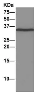 Immunoprecipitation - Anti-DNAJC9 antibody [EPR9856] (AB166612)