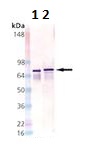 Western blot - Anti-DnaK antibody [8E2/2] (AB69617), expandable thumbnail