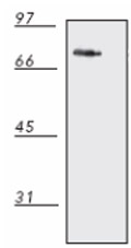 Western blot - Anti-DnaK antibody [8E2/2] (AB69617), expandable thumbnail