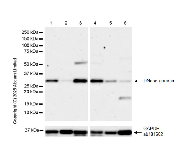 Western blot - Anti-DNase gamma antibody [EPR30746-557] (AB324943)