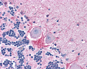 Immunohistochemistry (Formalin/PFA-fixed paraffin-embedded sections) - Anti-DNase I antibody (AB113241)