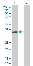 Western blot - Anti-DNase I antibody (AB167580)