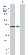 Western blot - Anti-DNase I antibody (AB167580)