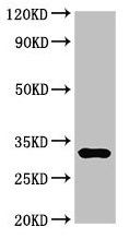 Western blot - Anti-DNase I antibody (AB224617)