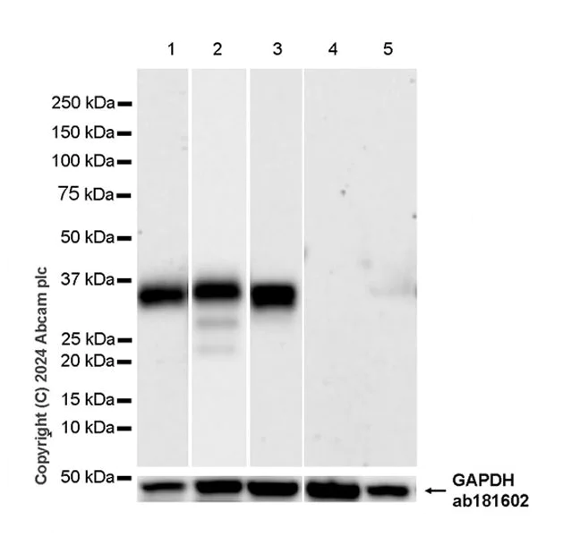 Western blot - Anti-DNase I antibody [EPR28421-50] (AB321980)