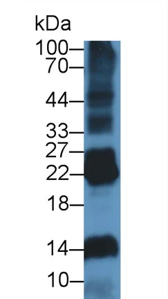 Western blot - Anti-DNASE1L2/DHP1 antibody (AB231232)