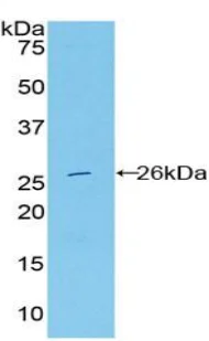 Western blot - Anti-DNASE1L2/DHP1 antibody (AB231232)