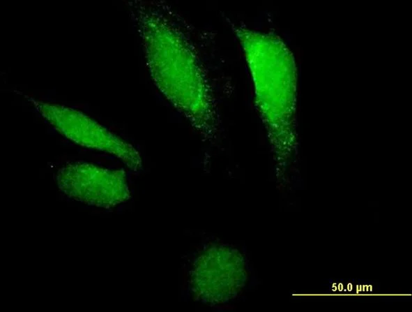 Immunocytochemistry/ Immunofluorescence - Anti-DNASE2 antibody (AB168782)
