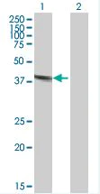 Western blot - Anti-DNASE2 antibody (AB168782)
