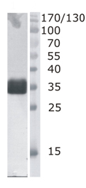 Western blot - Anti-DNaseI antibody [4B10] (AB138710)