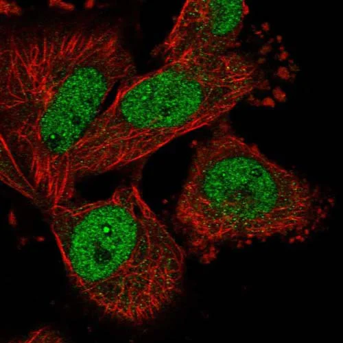 Immunocytochemistry/ Immunofluorescence - Anti-DNHD1 antibody (AB122574)